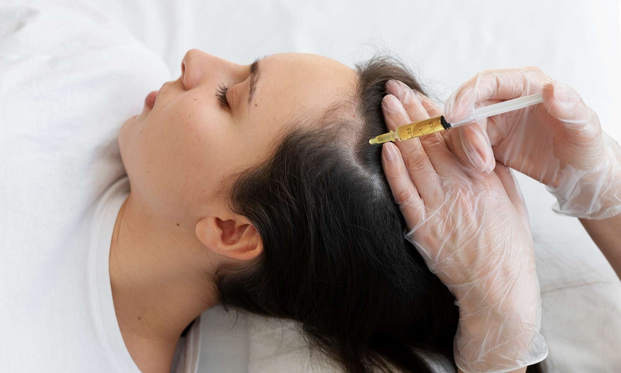 sahara-best-hair-treatment-in-dubai